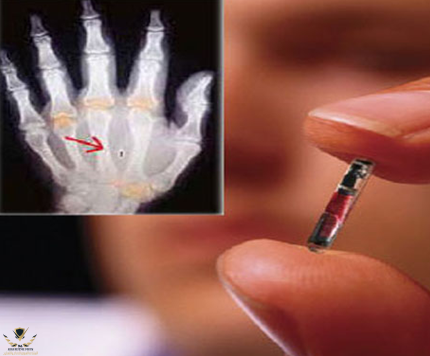 NBC-coverage-microchip-in-hand.png