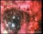 NGC2237s.jpg