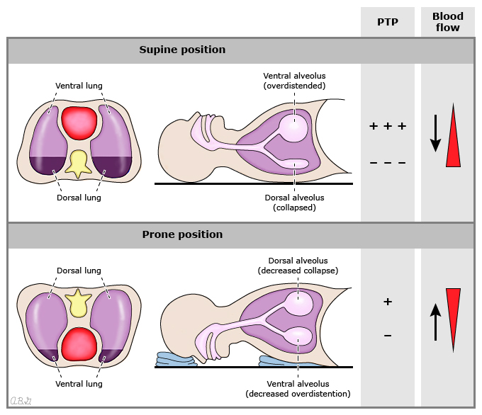 Physiologyproneposition.jpg