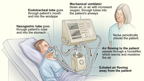 Ventilators_feat.jpg