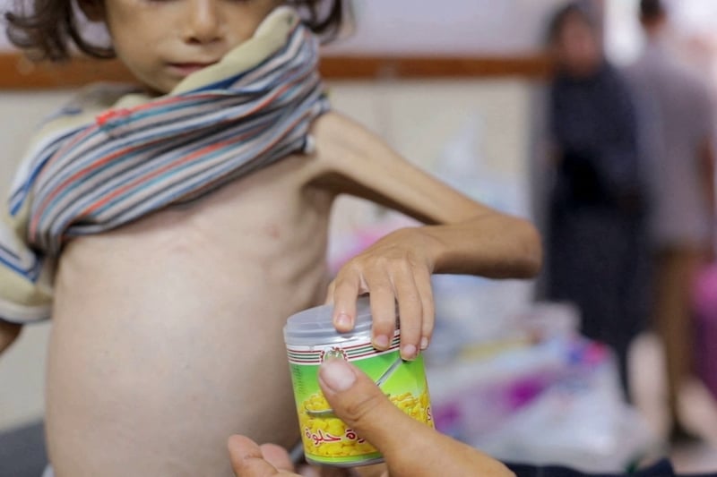 gaza-famine-enfant.jpg