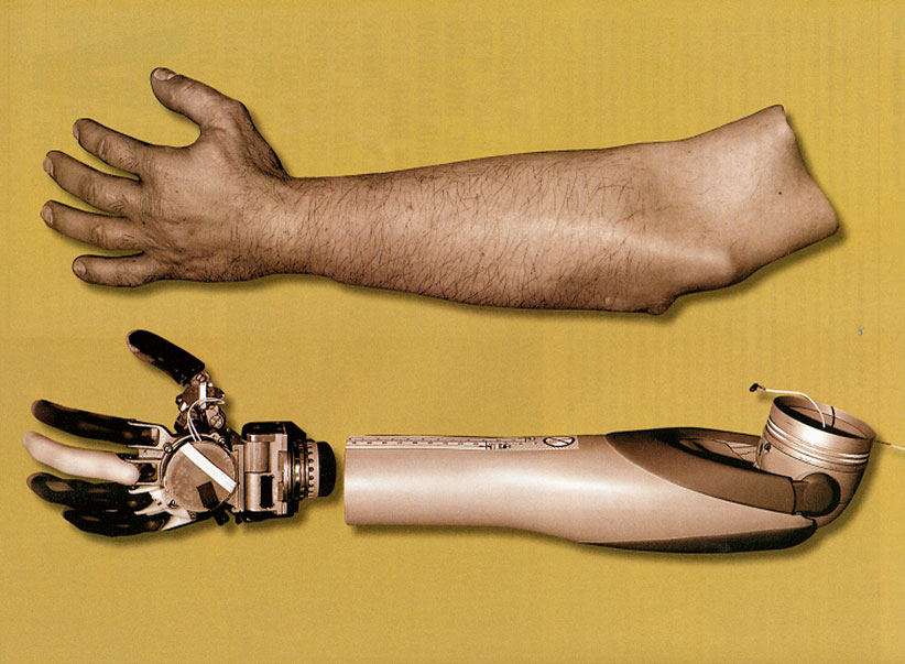 johns_hopkins_prosthetic_limb_darpa.jpg