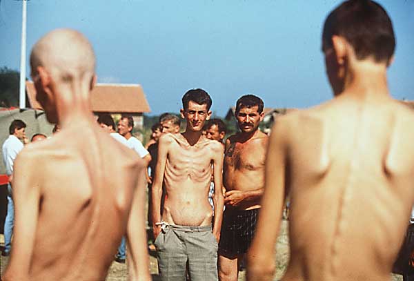 Bosnian+Genocide%252C+Trnopolje+Concentration+Camp+in+Bosnia+1992.jpeg
