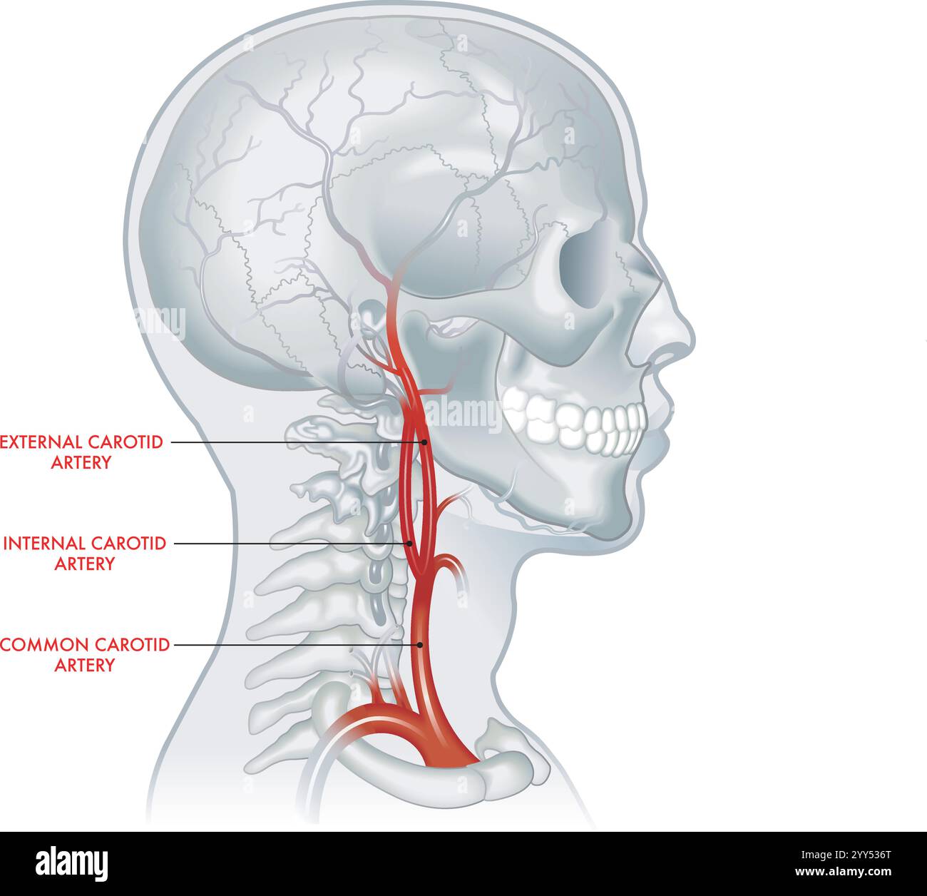 medical-illustration-of-carotid-artery-with-annotations-2YY536T.jpg